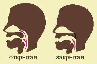 Открытая и закрытая ринолалия